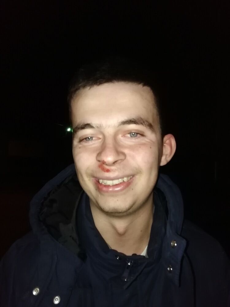  18531451  , 35 ,    