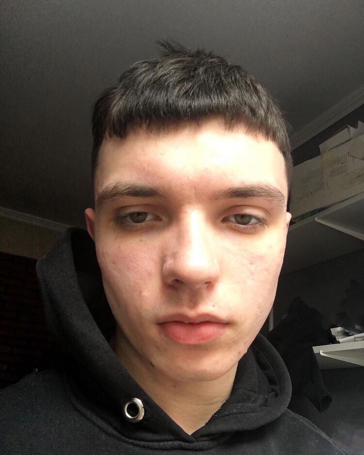  32030771  Denis, 22 ,    
