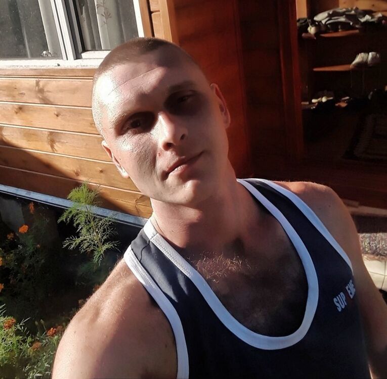  17863741  , 35 ,    