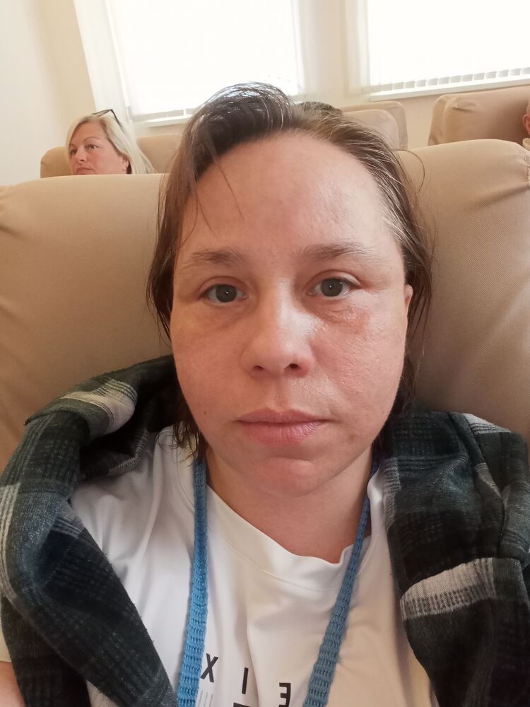  38283731  , 49 ,    -