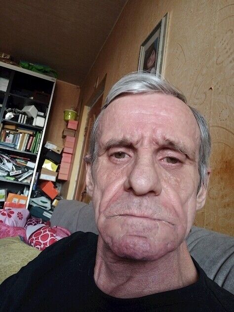  20495661  , 66 ,    