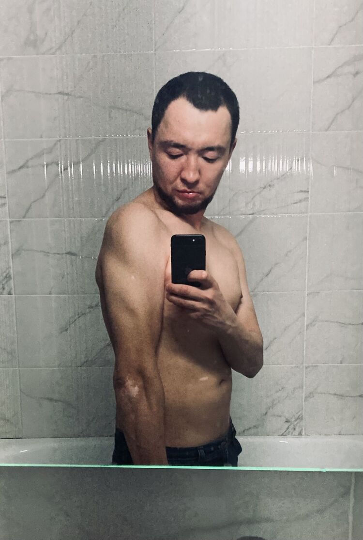  33233571  , 35 ,    