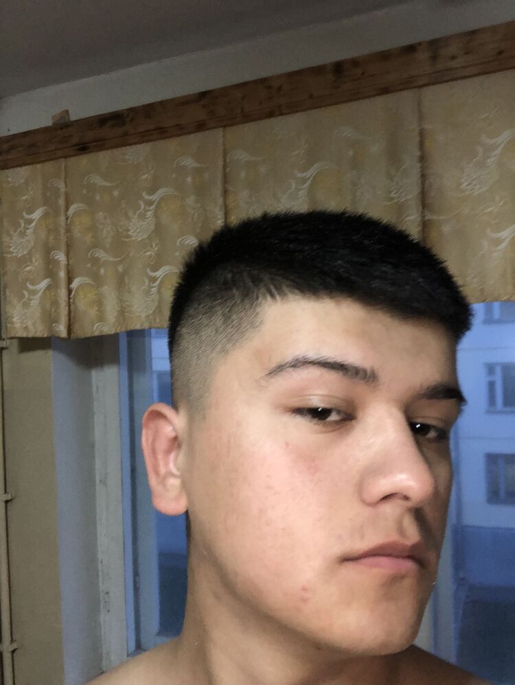  44813681  , 29 ,    
