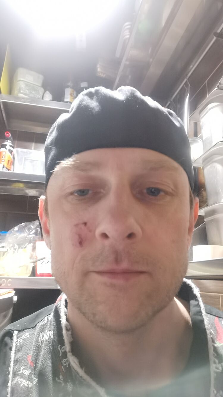  26332321  , 43 ,    -