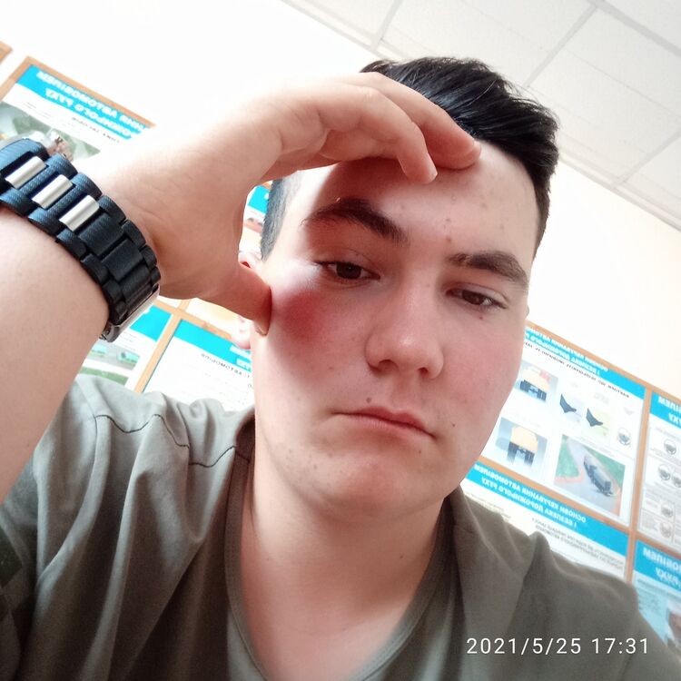  23038661  , 24 ,    