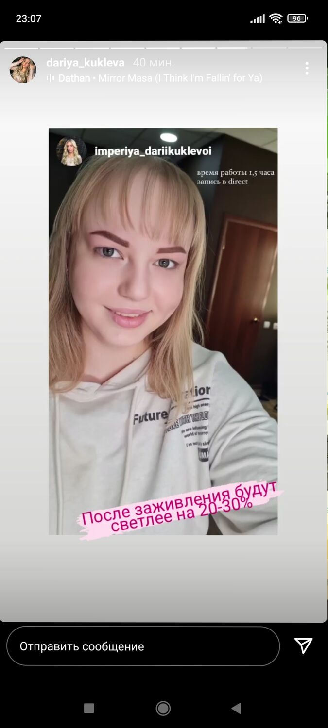 34903971  , 36 ,    