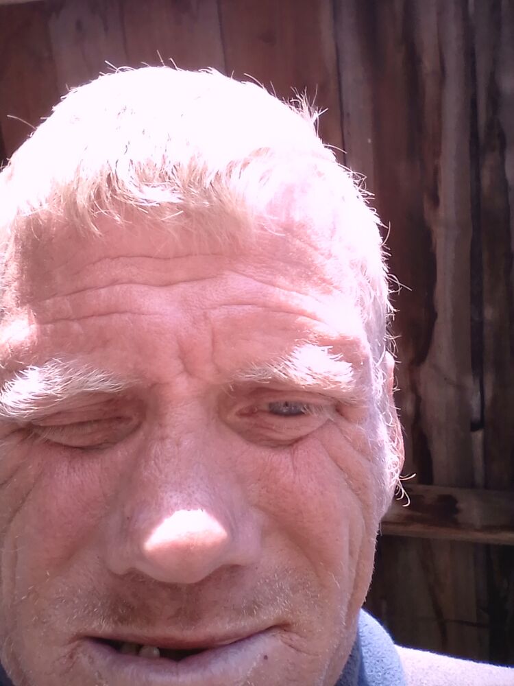  42917931  , 45 ,    