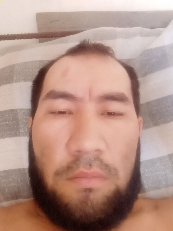  34925401  , 40 ,    