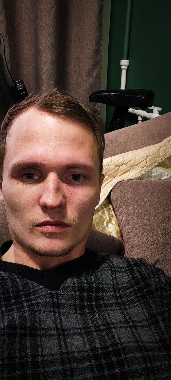  36809881  Denis, 25 ,    