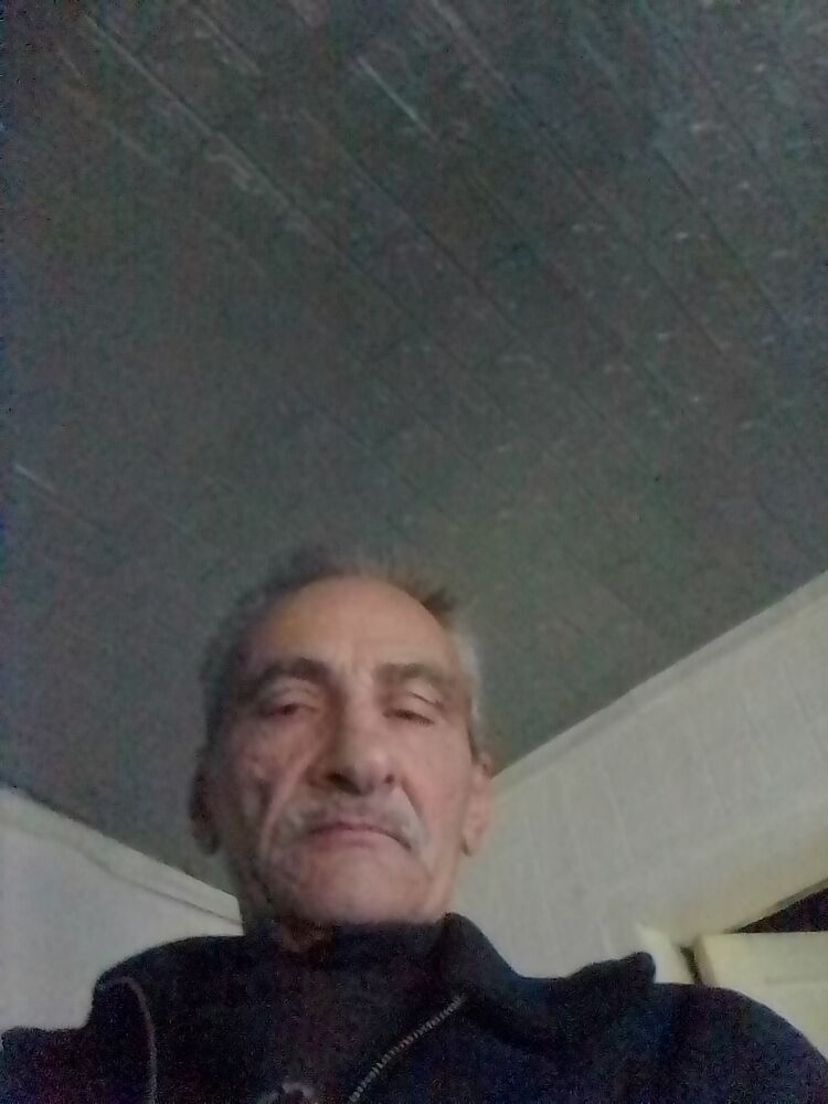  49336441  , 57 ,    