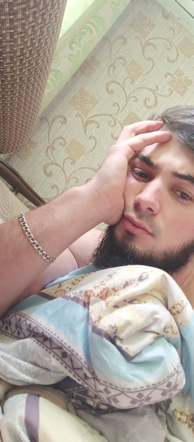  33382461  Ahmed, 29 ,    