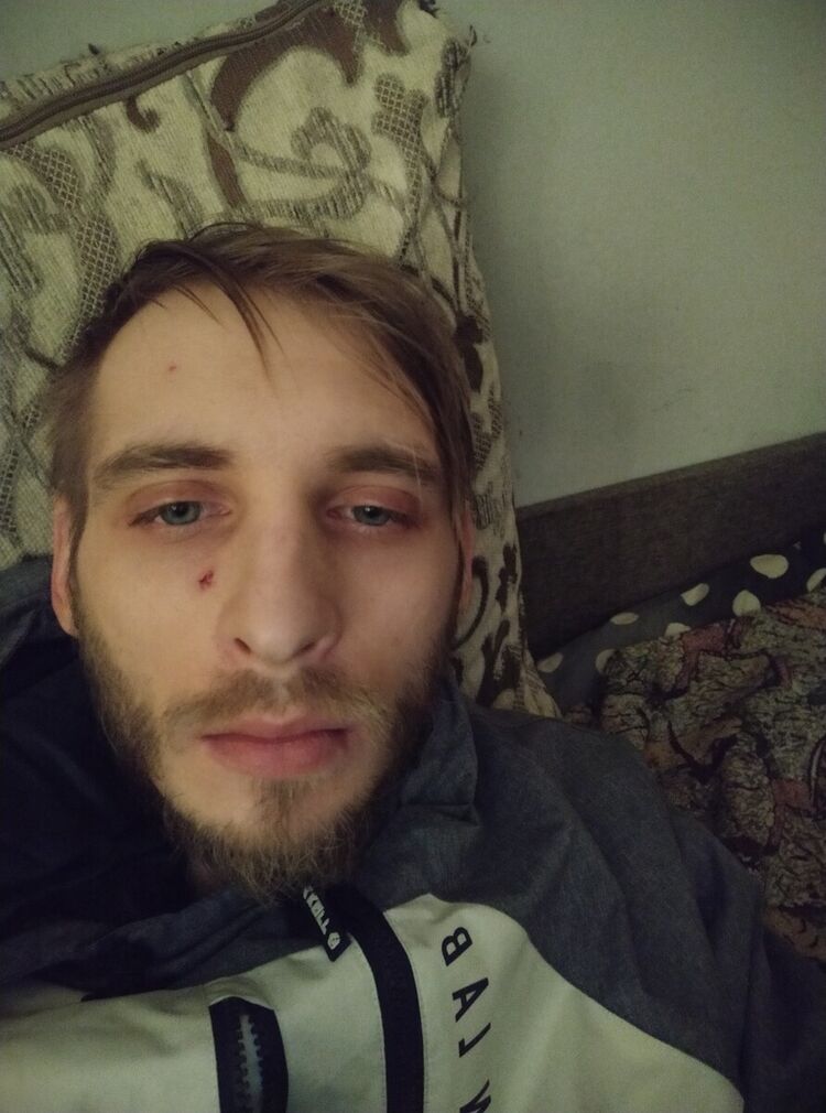 ���������� �����-���������, ���� ������� DapS, 33 ����, ������������ ��� ������, ����� � ���������