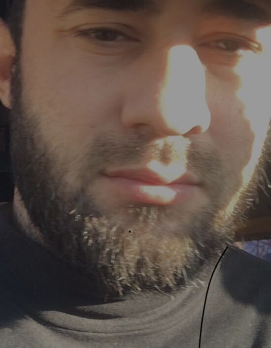  45448881  , 31 ,    