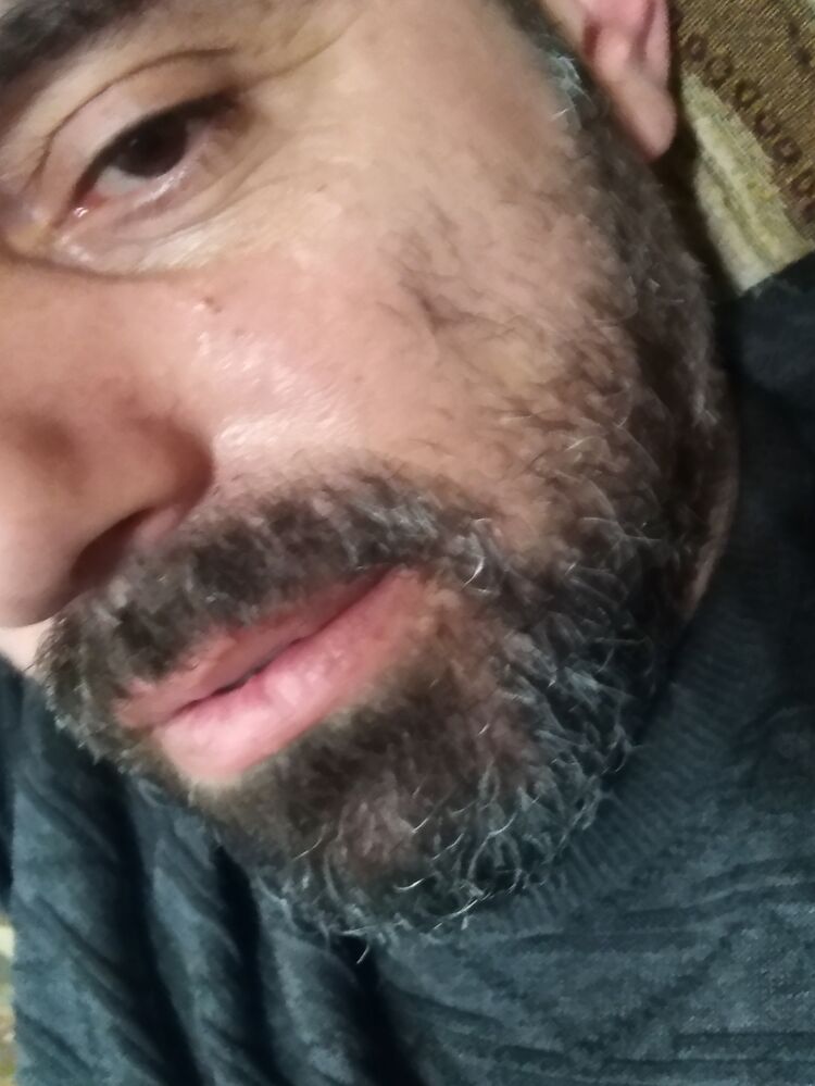  45493851  , 36 ,    --