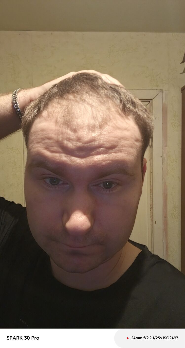 48966471  , 28 ,    