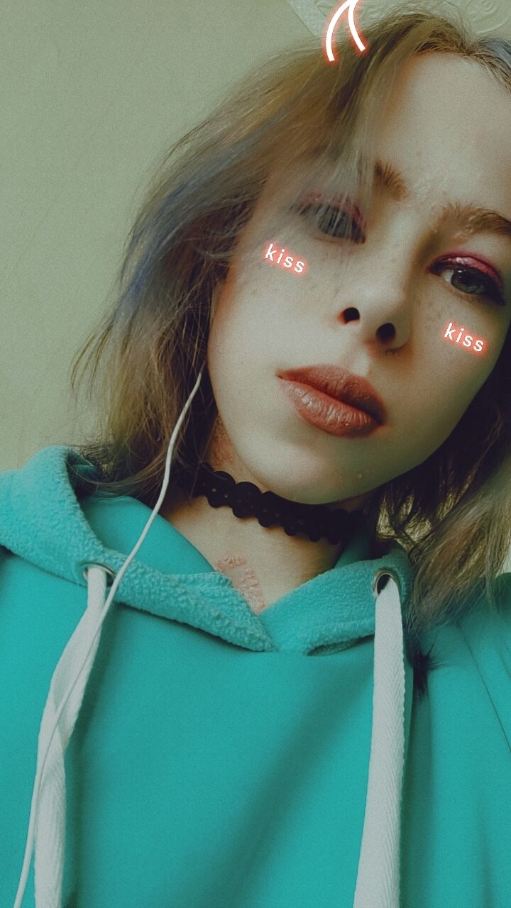  33928571  Dead, 20 ,    
