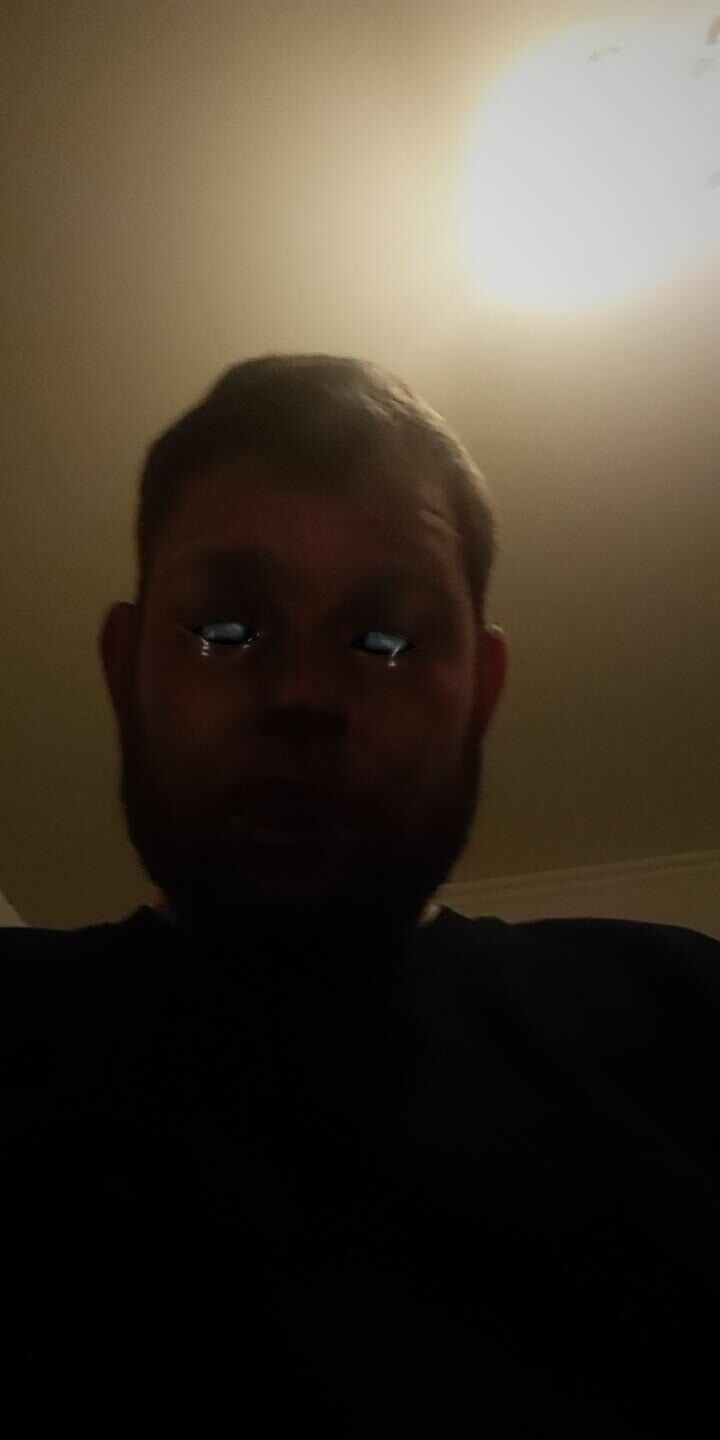  35562741  , 44 ,    