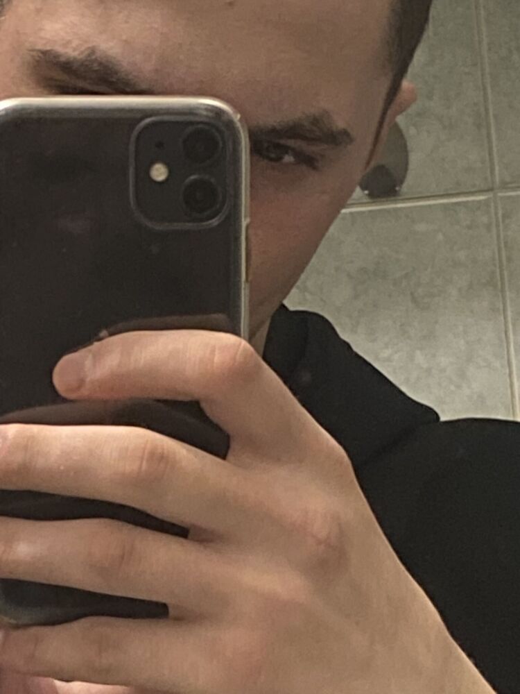  44171581  , 22 ,    