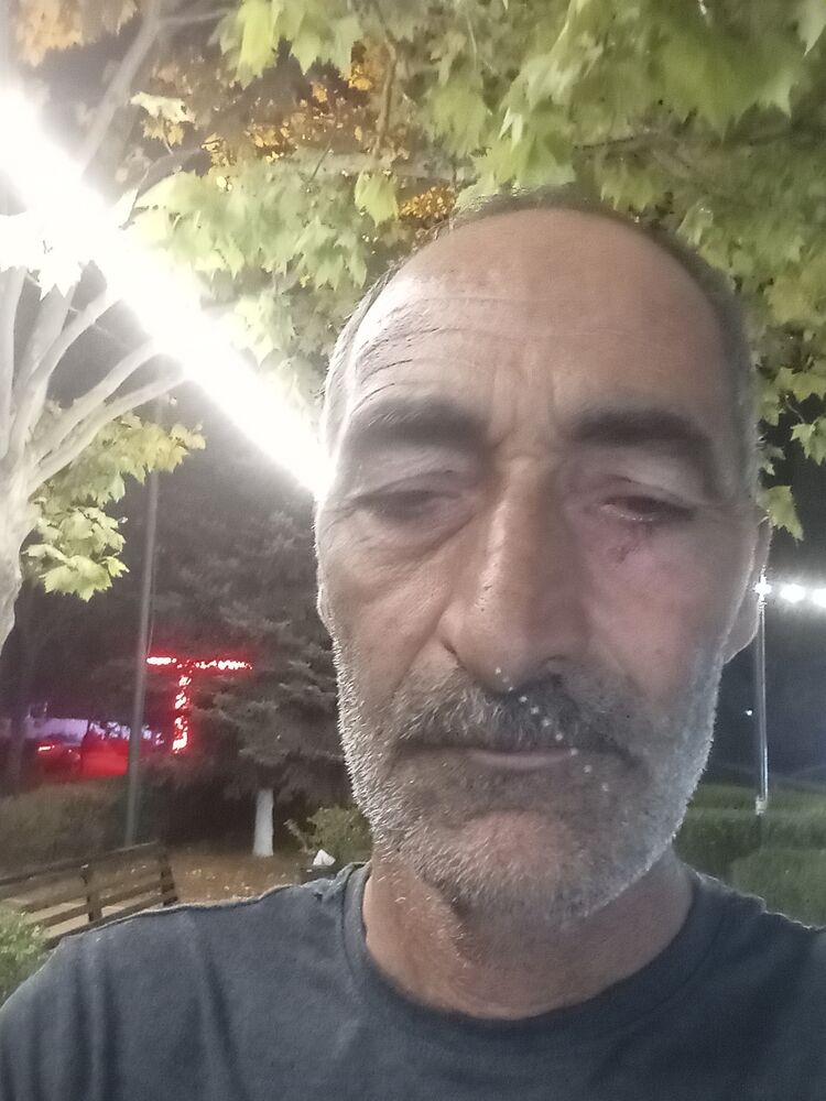  47375721  , 56 ,    