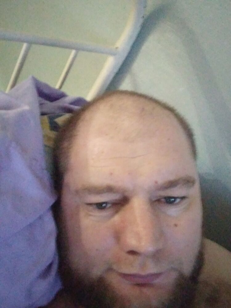  18864671  , 39 ,    
