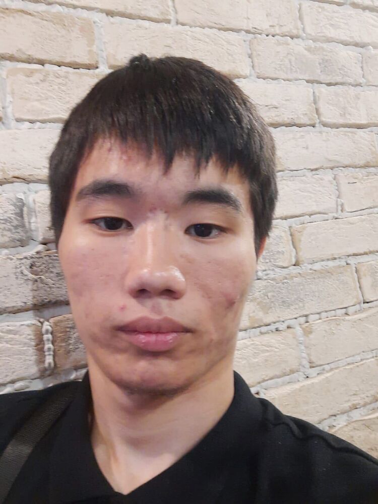  32573661  , 24 ,    