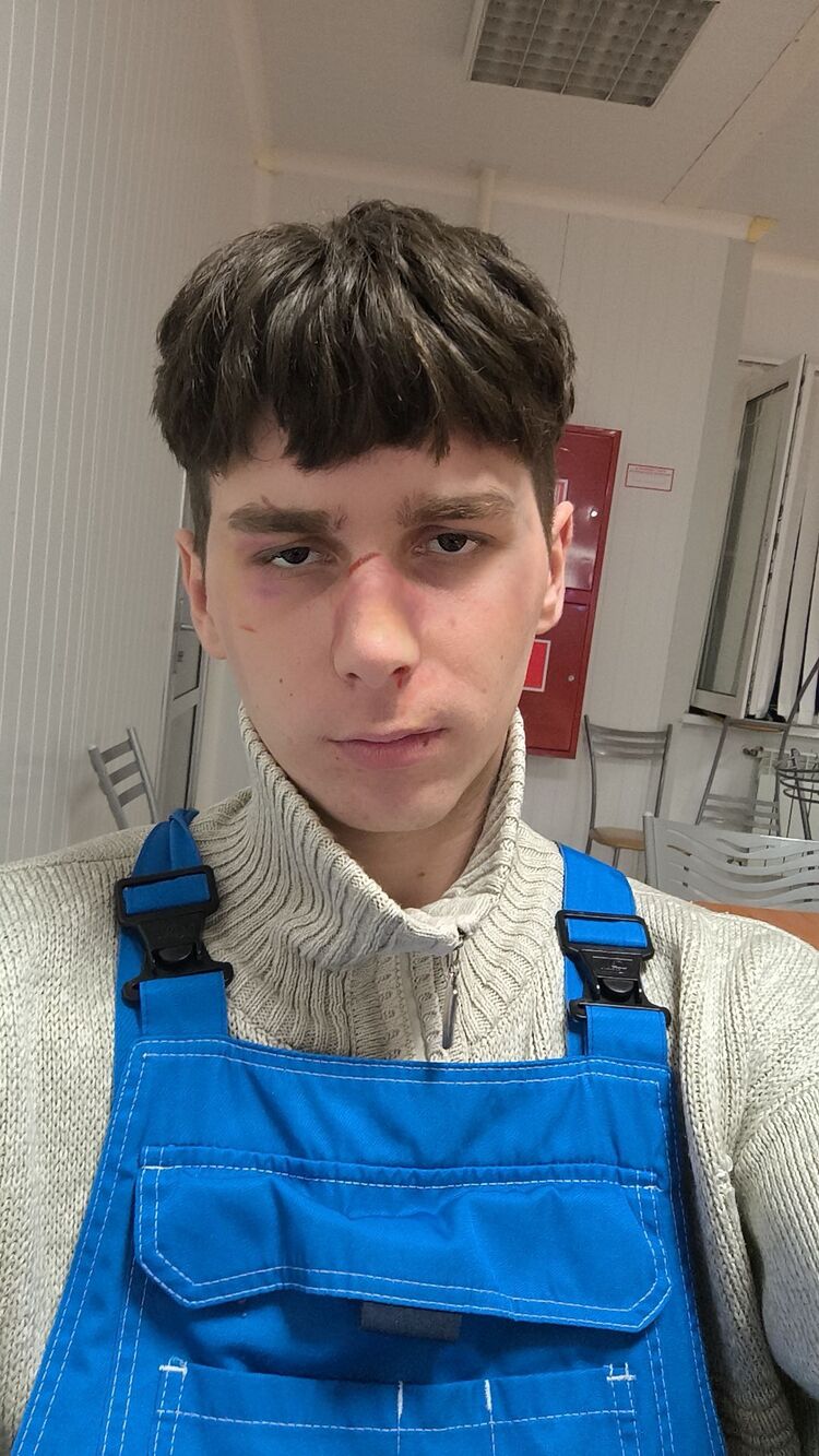  45778181  , 22 ,    