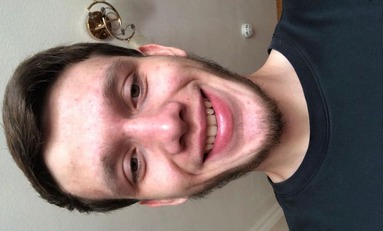  34471941  , 35 ,    