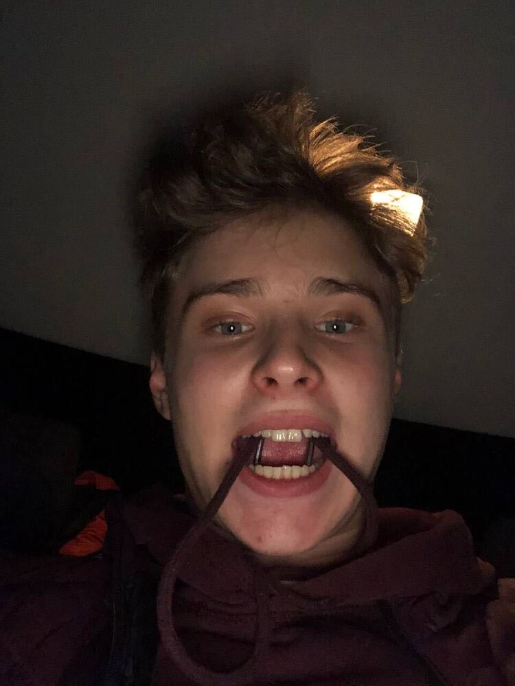  43555581  Ck, 22 ,    -