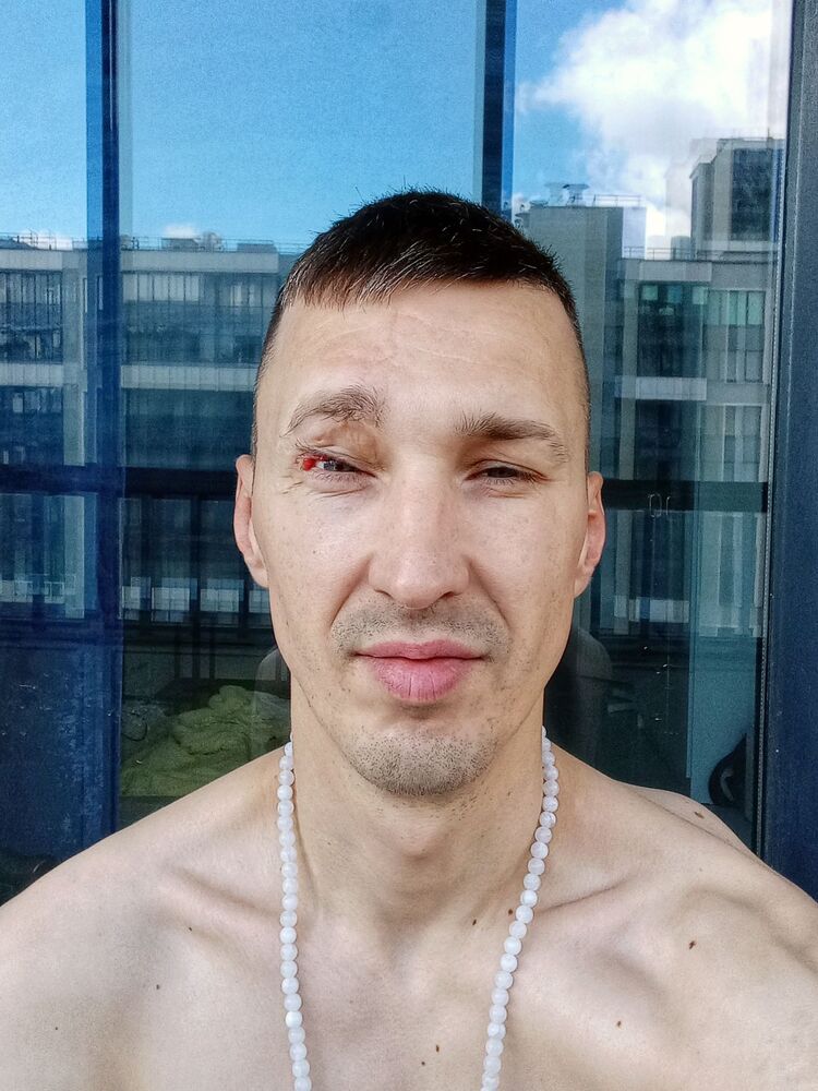  44649881  , 35 ,    -