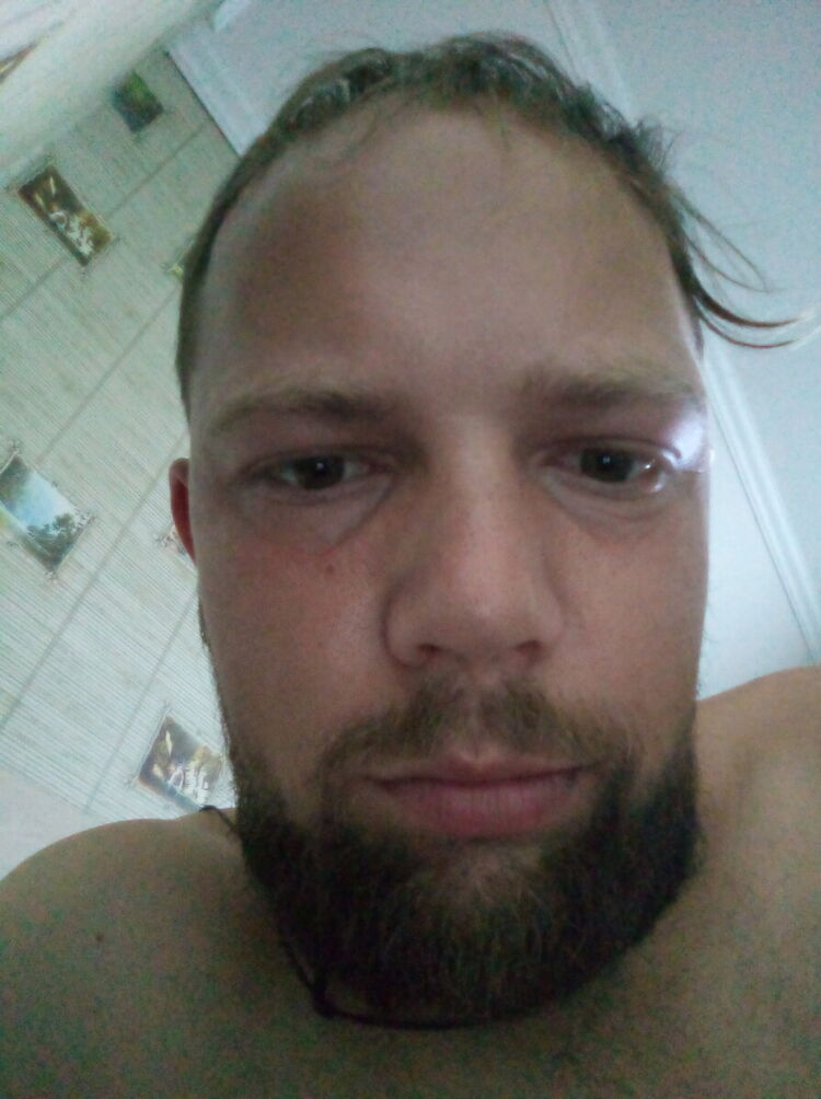 20957381   , 35 ,    