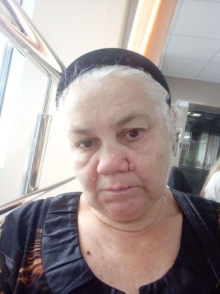  47079581  , 58 ,    