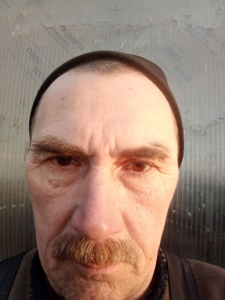  33416091  , 65 ,    