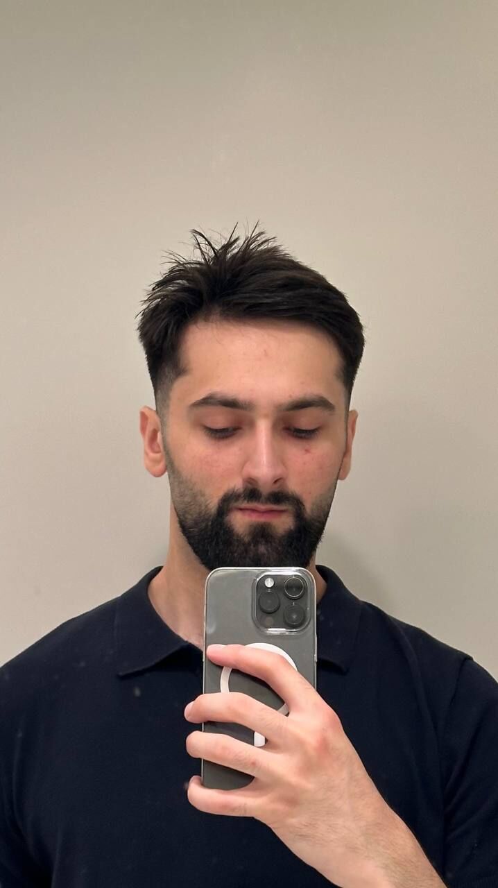 ���� 45812981 ������� ����, 35 ���, ���� ���������� � ������