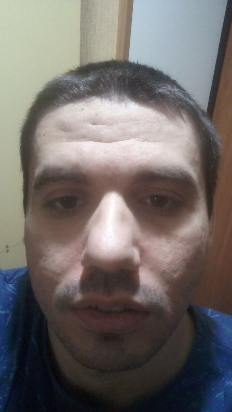  40562141  , 33 ,    