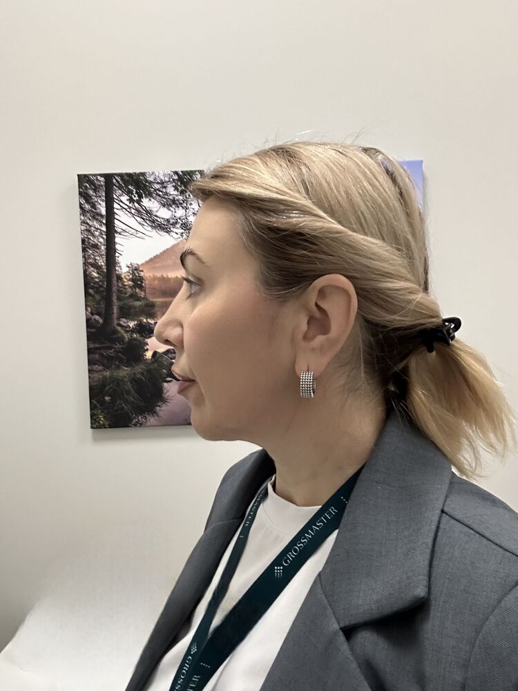  54232931  , 39 ,    -