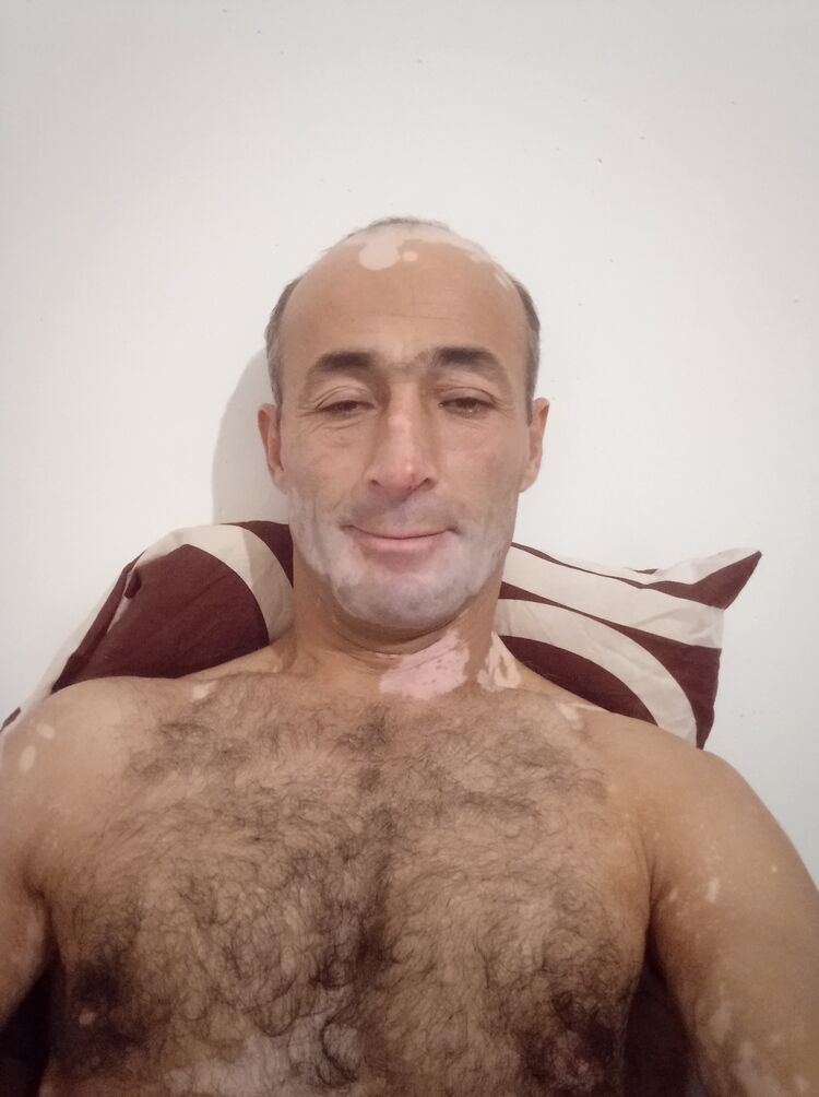  30576511  , 44 ,    