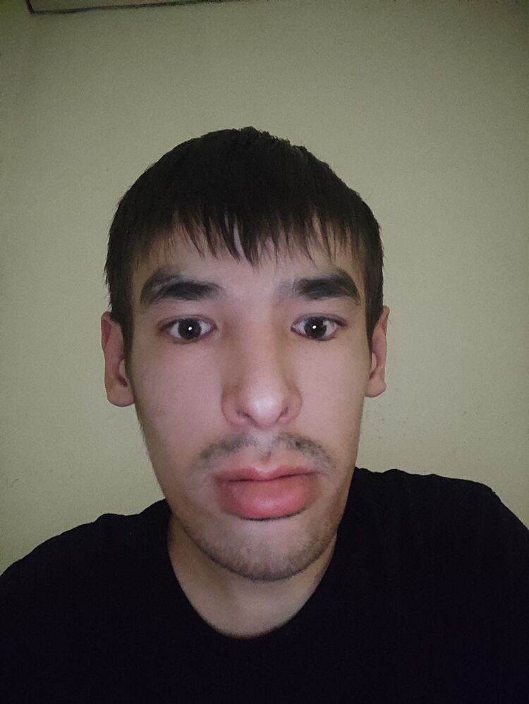 49953211  , 28 ,    
