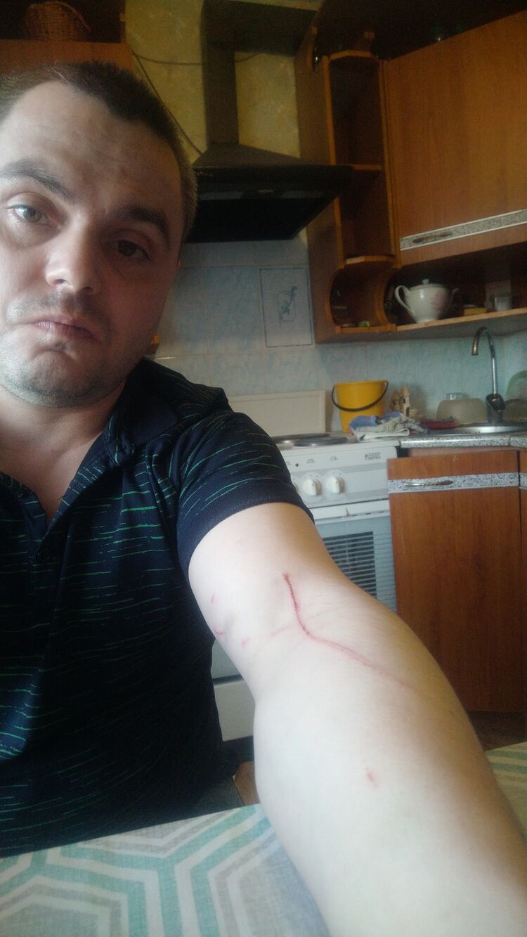  43946681  , 41 ,    