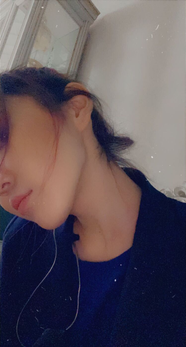  24739021  , 25 ,    