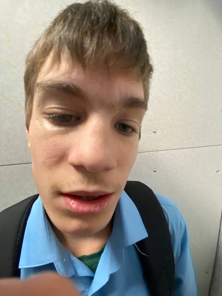  54503171  Nut, 18 ,    -