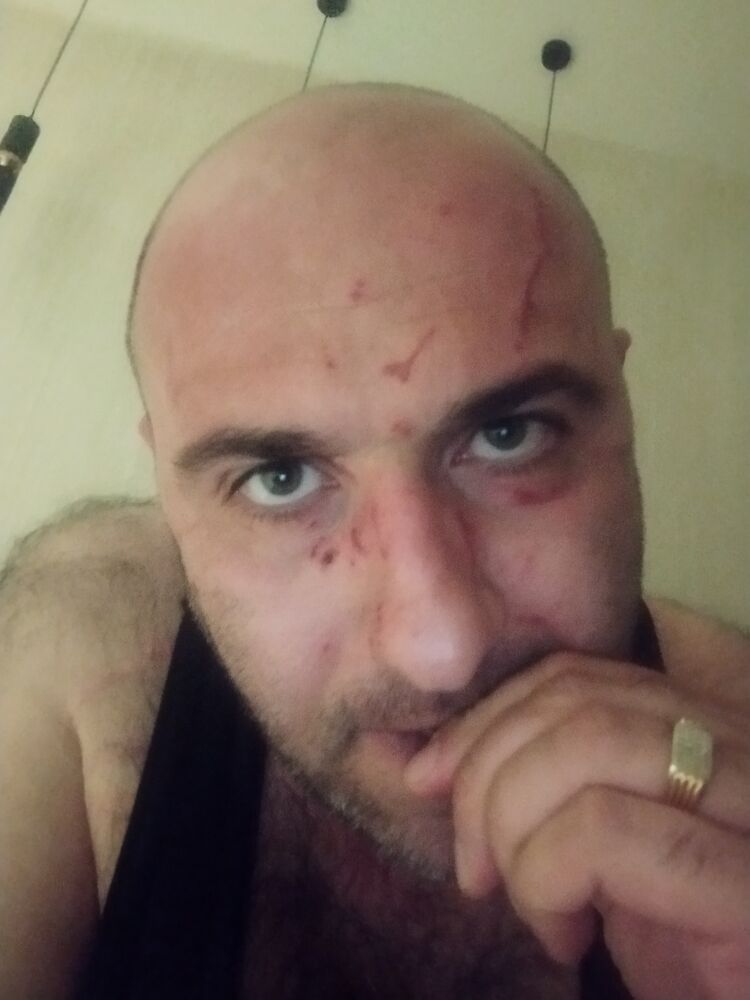  52725701  , 36 ,    