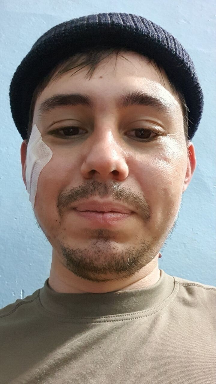  51640491  , 32 ,    --