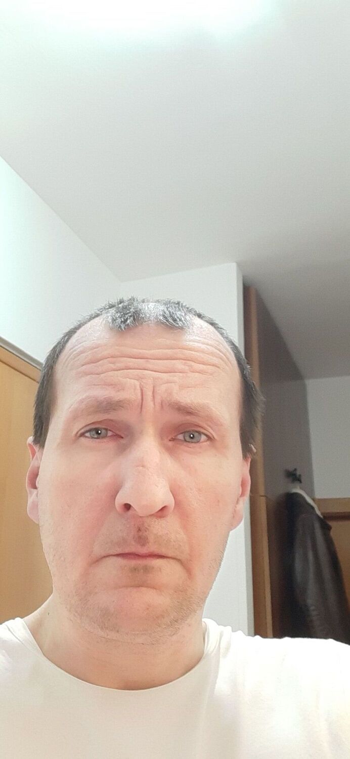  24714931  , 44 ,    