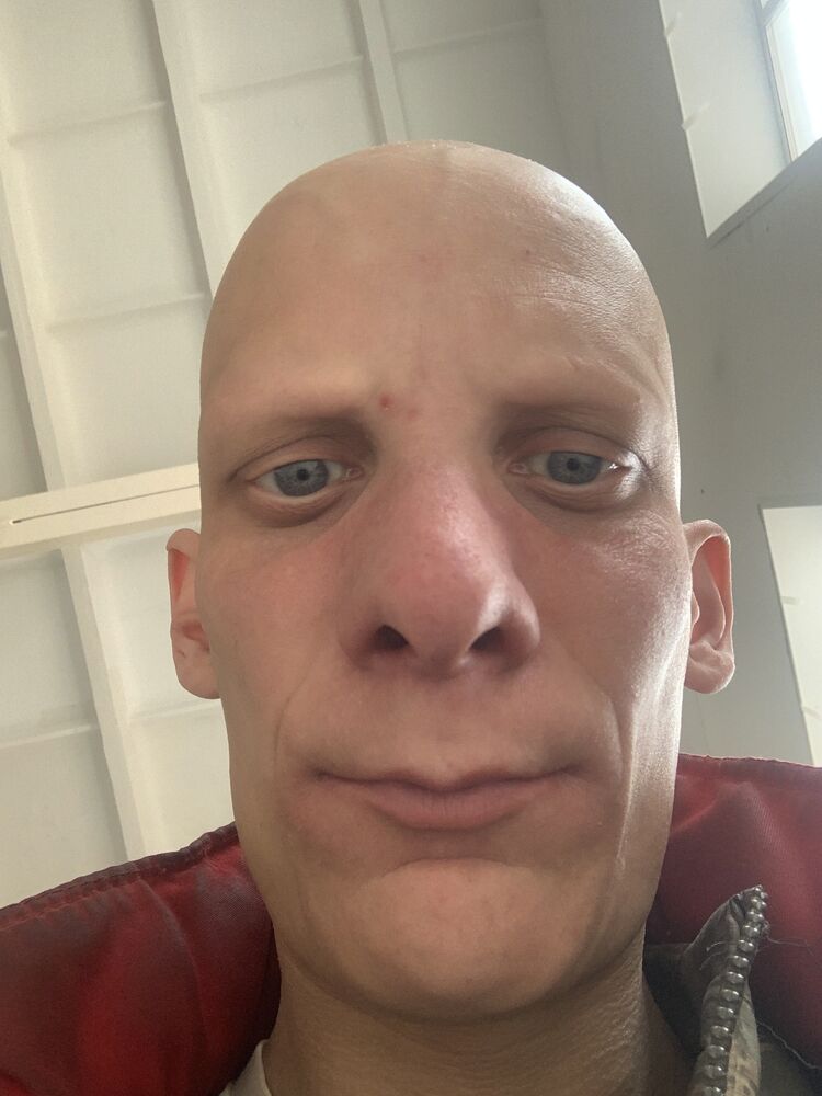  42581621  , 35 ,    
