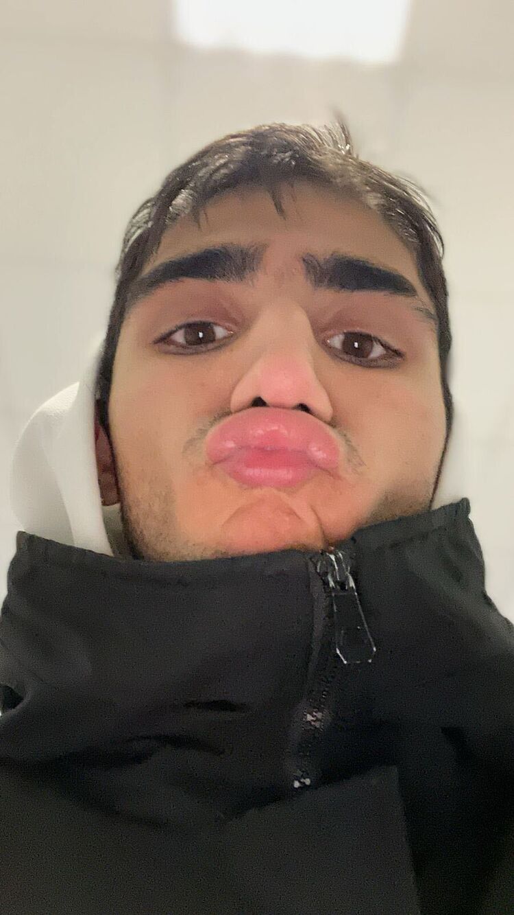  48949841  Ako, 22 ,    