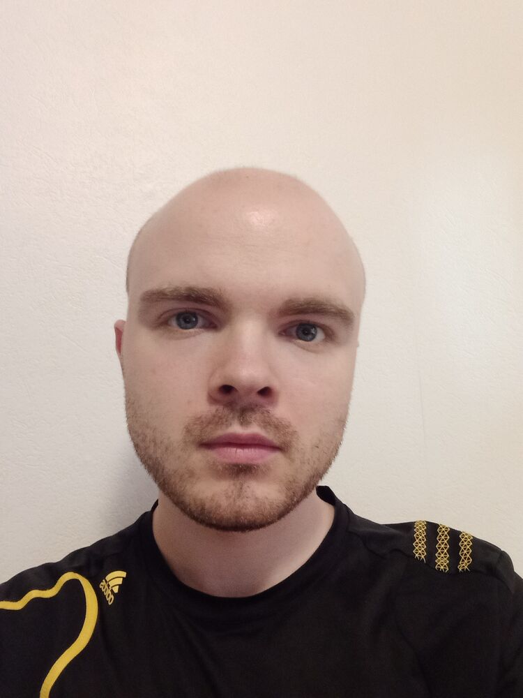  28287681  , 31 ,    