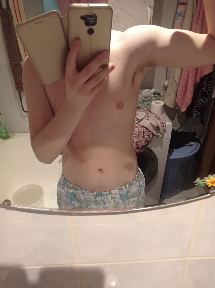  34429741  , 24 ,    