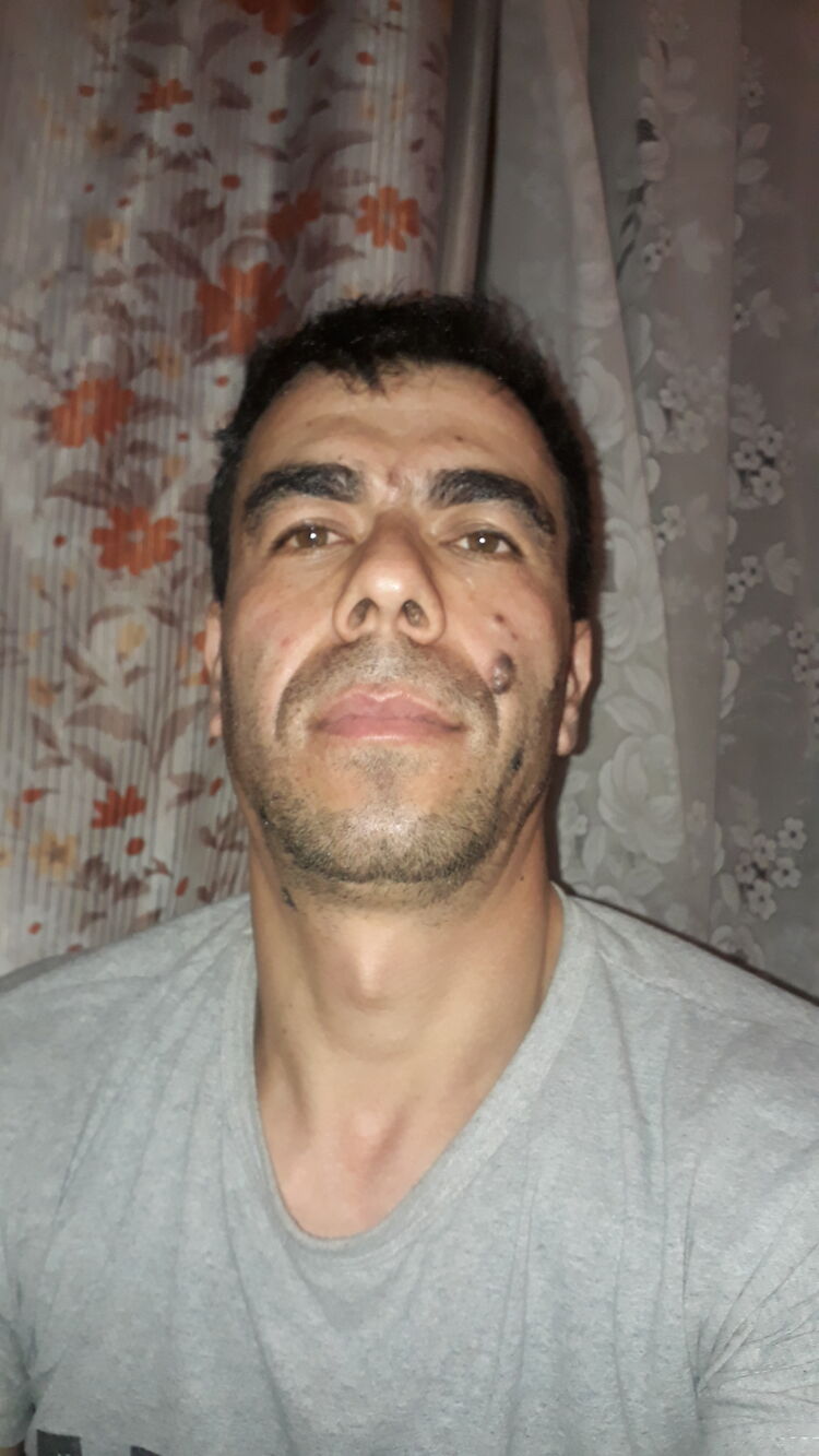  41628271  , 36 ,    