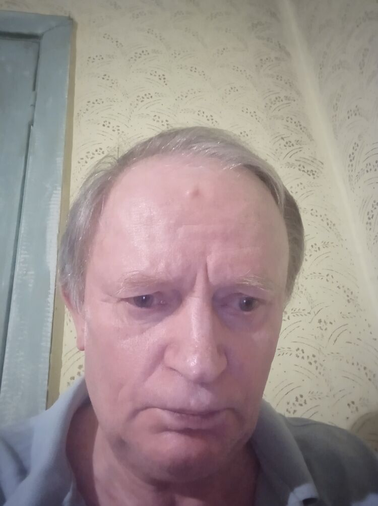  47744171  , 70 ,    