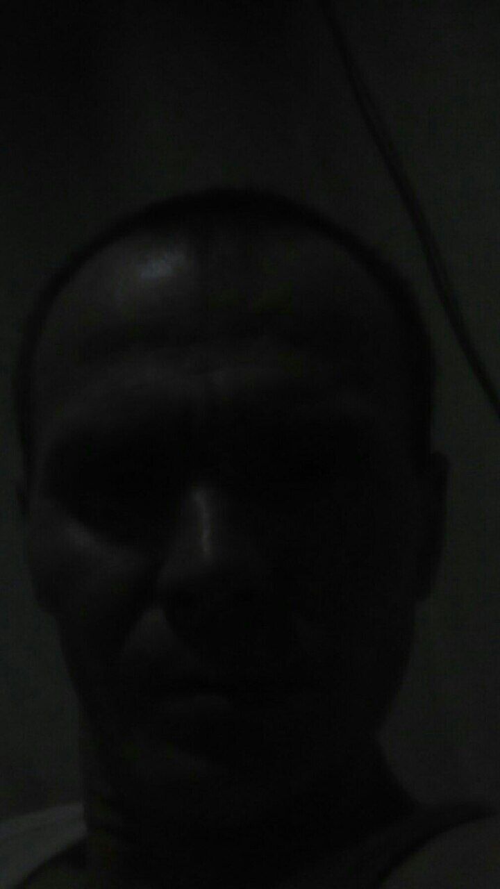  29556281  , 45 ,    